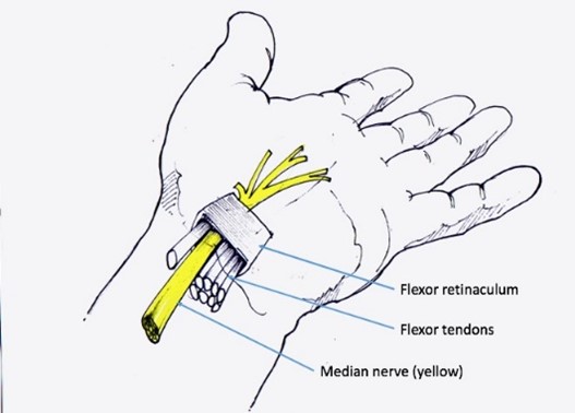 Carpal tunnel