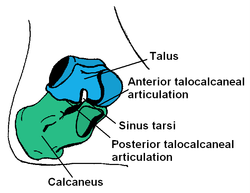 Arthritis of the ankle