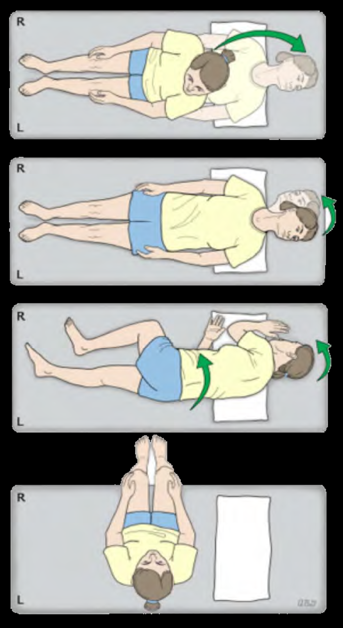 Diagram showing Epley manoeuvre for BPPV