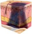 Suspected deep tissue injury