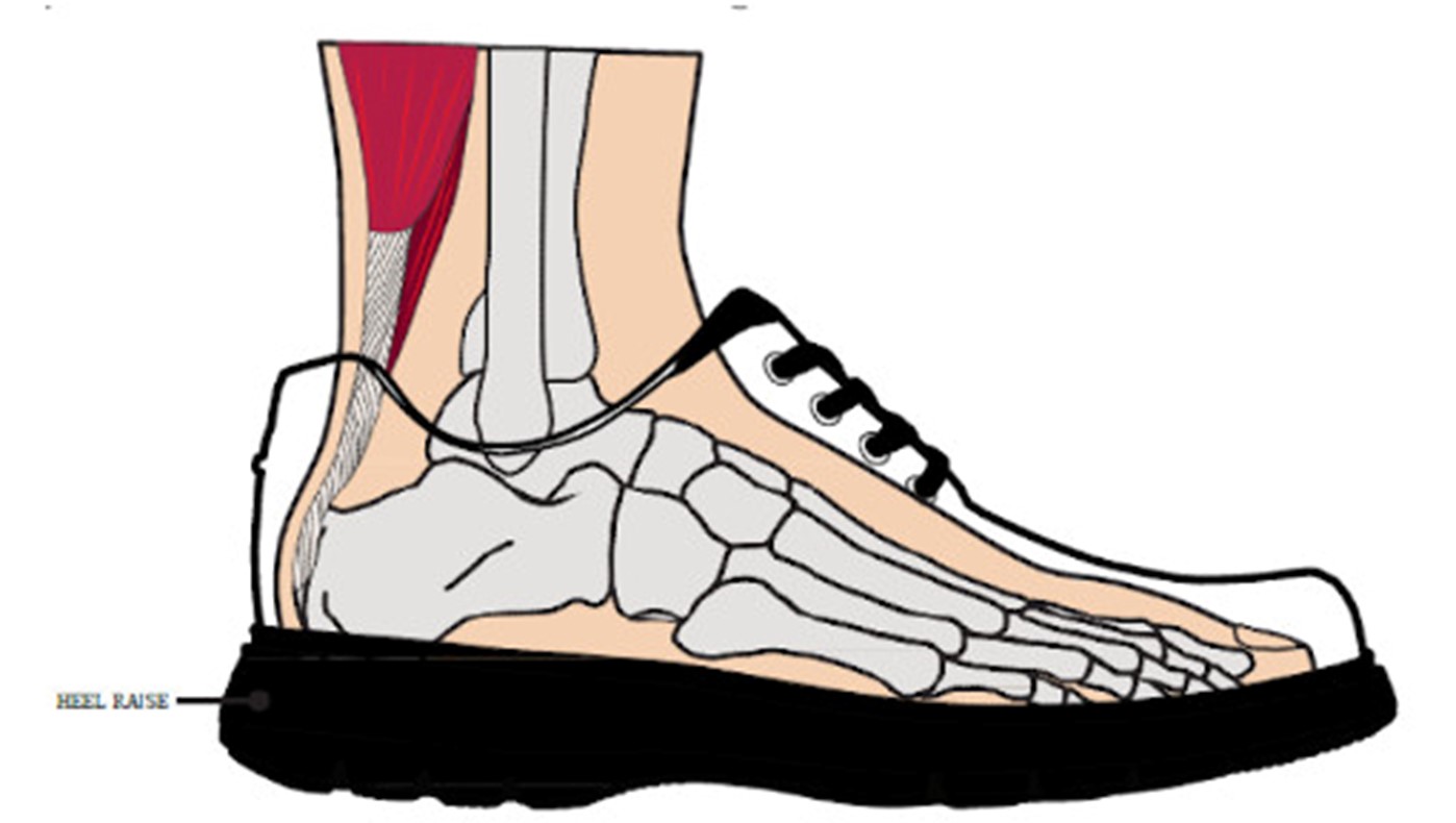 achilles tendinopathy 3